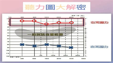 噪音符號|聽力圖判讀：基礎篇 – 職醫要走